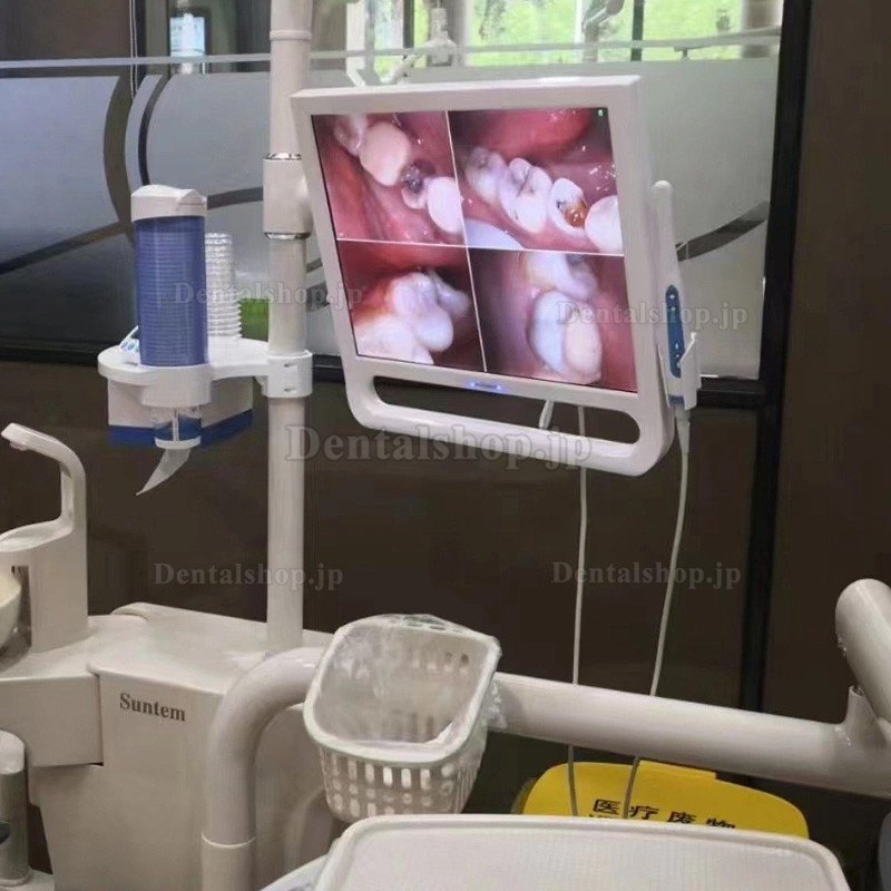 Magenta YF1700M 歯科口腔内カメラ 17インチスクリーンとWIFI付き